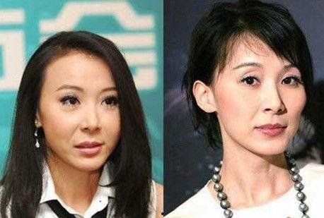 整容失败的明星网红,网红明星的美丽代价