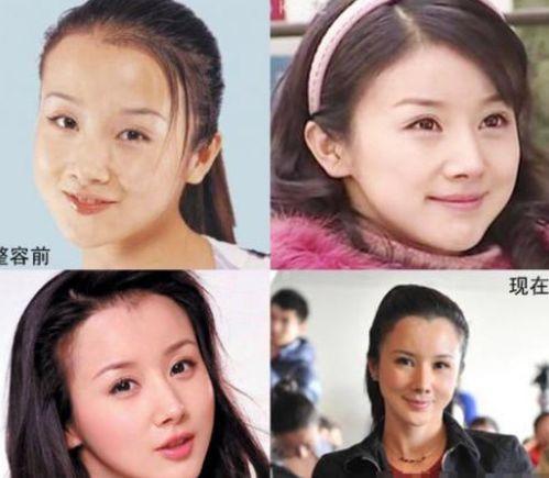 整容失败的明星网红,网红明星的美丽代价