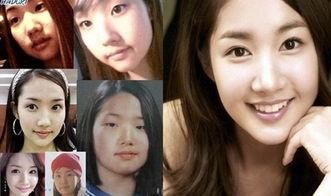 整容后女明星网红,揭秘整容后女明星网红的华丽转身